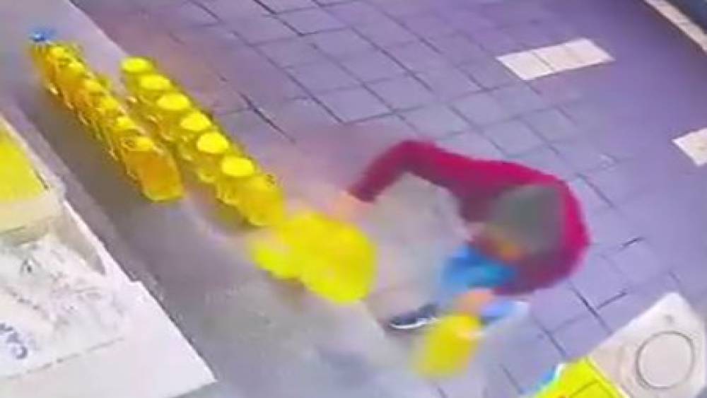 Kaşla g&ouml;z arasında sıvı yağları alıp ka&ccedil;tı
