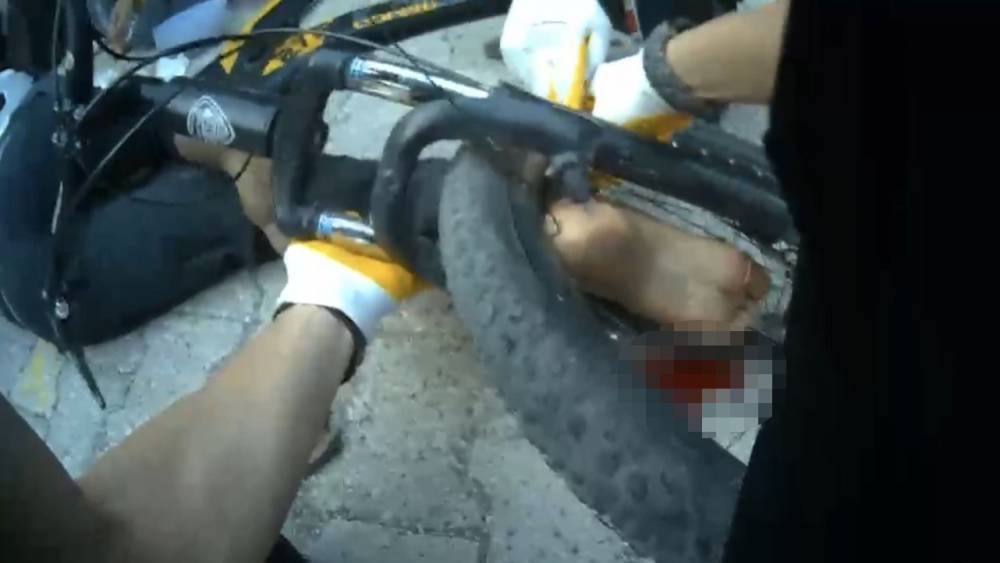 Osmaniye&rsquo;de ayağı bisikletin tekerine sıkışan &ccedil;ocuk ekiplerce kurtarıldı
