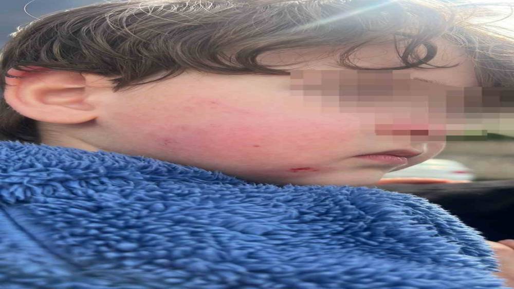 Kreşe bıraktığı &ccedil;ocuğunu darp edilmiş halde aldı
