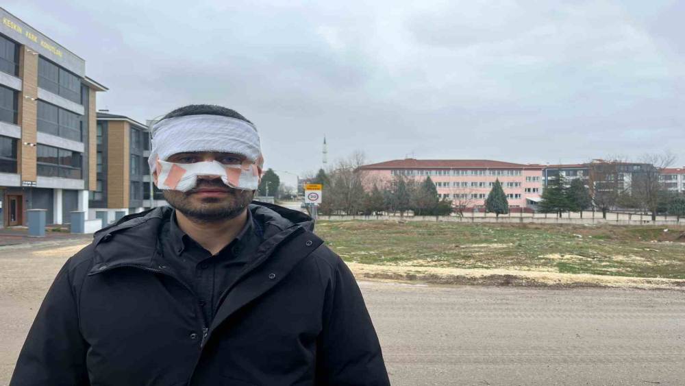 Rehber &ouml;ğretmenin y&uuml;z&uuml;ne sıcak &ccedil;ay fırlattığı fizik &ouml;ğretmeni feci şekilde yandı
