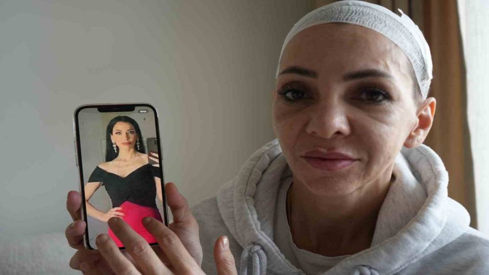 Anne ve oğlunu &ouml;ld&uuml;resiye darp eden ş&uuml;pheliler: "Merdivenlerden d&uuml;şt&uuml;"
