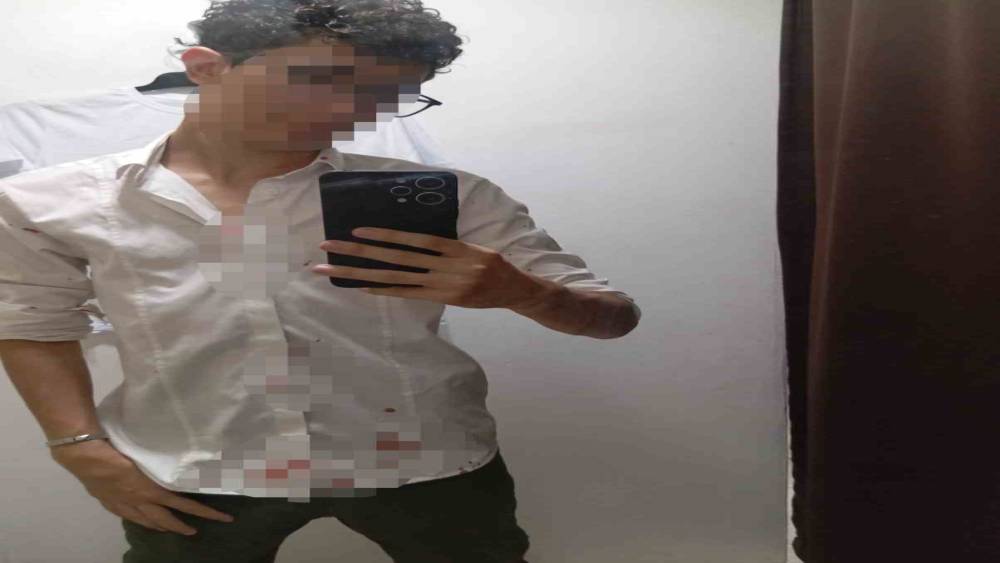 K&uuml;&ccedil;&uuml;k&ccedil;ekmece&rsquo;de 16 yaşındaki &ccedil;ocuğu "fotoğraf &ccedil;ektin" iddiasıyla darbettiler
