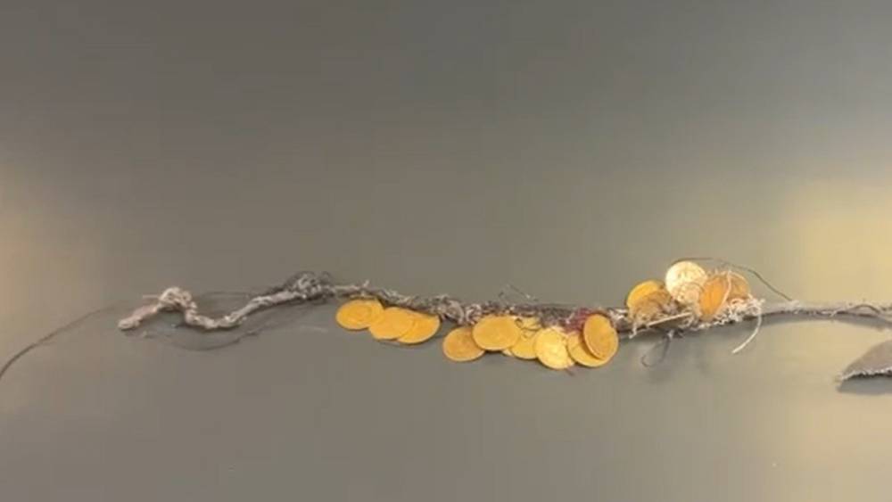 Kadının boynundaki 185 bin TL değerindeki 17 &ccedil;eyrek altın b&ouml;yle &ccedil;alındı
