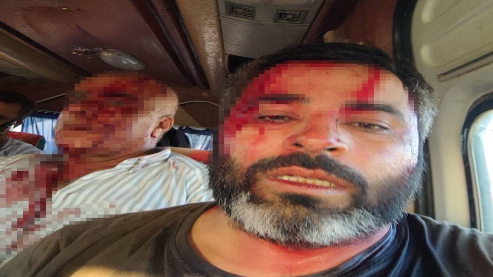 Ak&ccedil;akale&rsquo;de meydan savaşı gibi kavga: 8 yaralı
